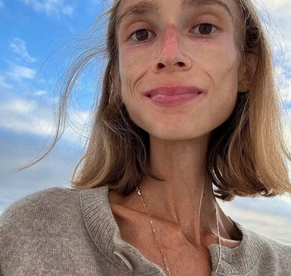 Умерла девушка, питавшаяся только фруктами — она весила чуть больше 20 кг Умерла девушка, питавшаяся только фруктами — она весила чуть больше 20 кг